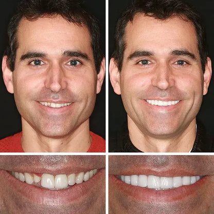 FDA-certified complete dentures (USA)