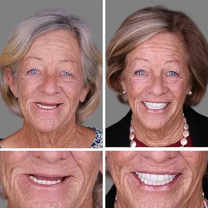 FDA-certified complete dentures (USA)