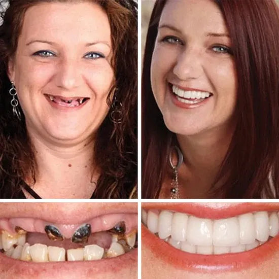 FDA-certified complete dentures (USA)