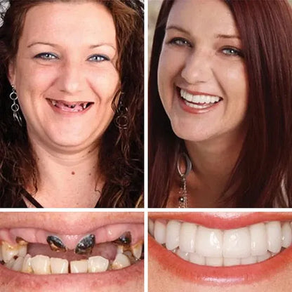 FDA-certified complete dentures (USA)